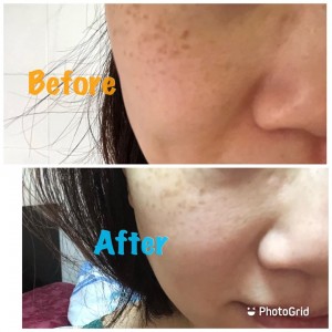 喝Bloom膠原蛋白飲, 皮膚變好了~