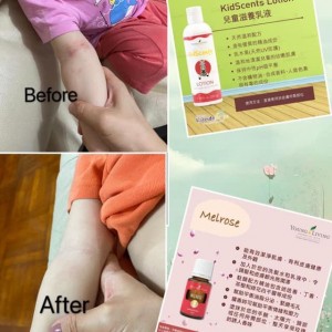 舒緩膏 (中國市場)