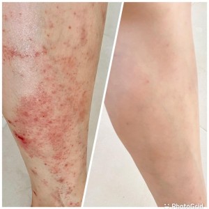 喝了膠原蛋白飲的意外收穫, 皮膚變好了!