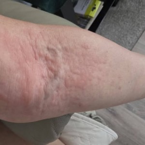 不知為何開始出現風癩